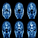 alcohol and neurological function